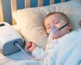 Śpiące dziecko z maską inhalacyjną podłączoną do nebulizatora. Dziecko przechodzi inhalacje z sody oczyszczonej, by ulżyć mu w oddychaniu.