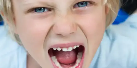 Zacięta mina dziecka, które krzyczy. Trudne stawianie granic dziecku, gdy emocje biorą górę.