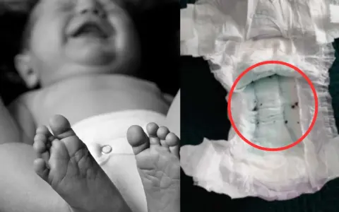 Dziecko w pampersie, obok zużyta pielucha z zielonym wkładem i ciemnymi grudkami.